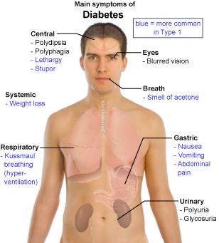 Main_symptoms_of_diabetes